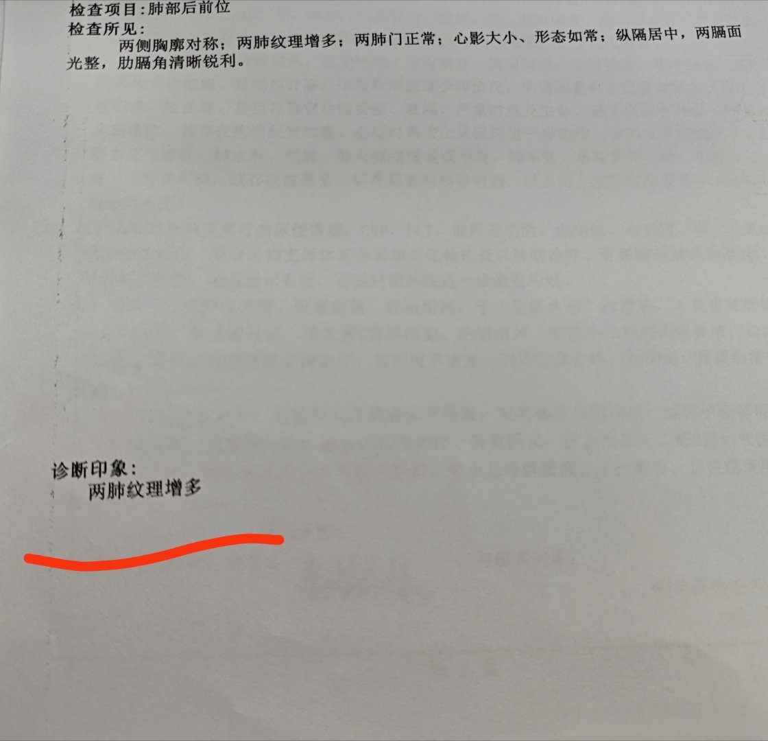 【青岛确诊病例是哪里的/青岛确诊患者】