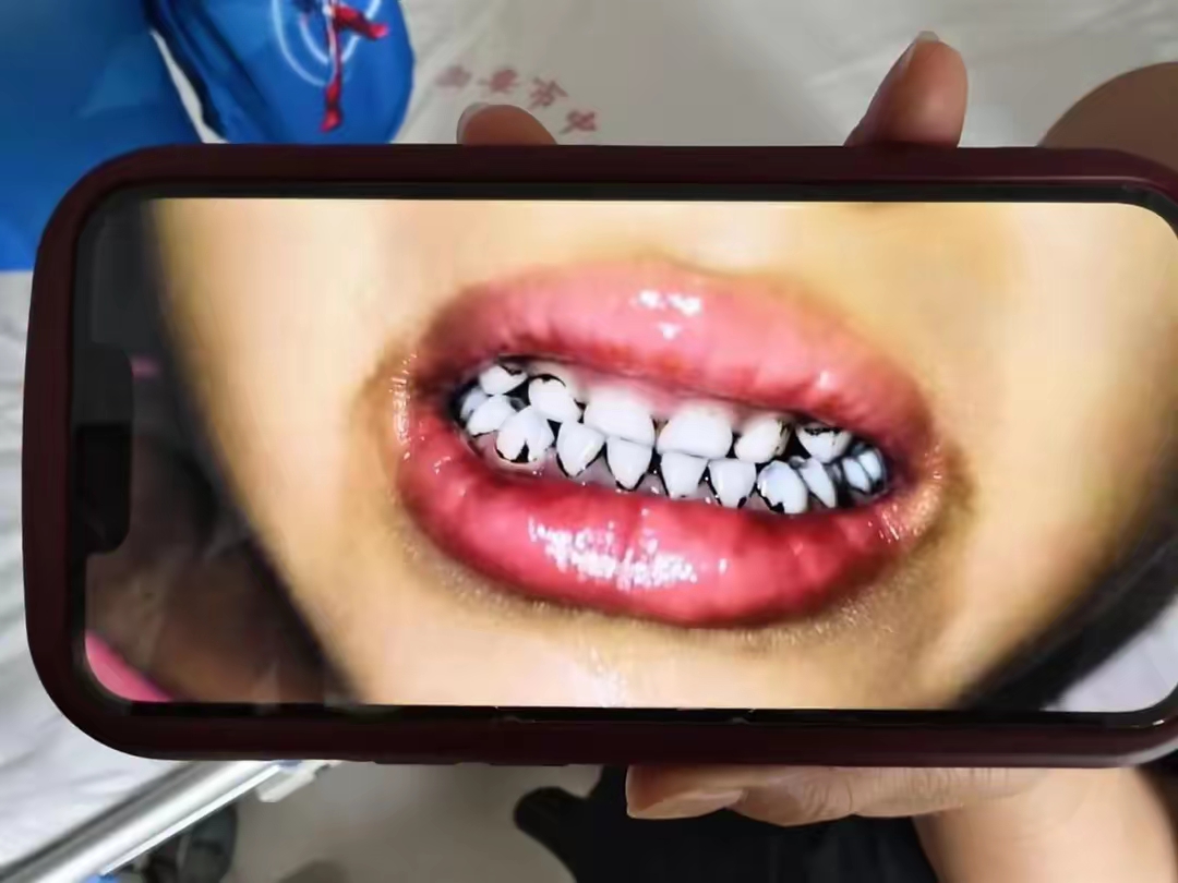 【西安新增病例/西安新增本土确诊病例】-第3张图片