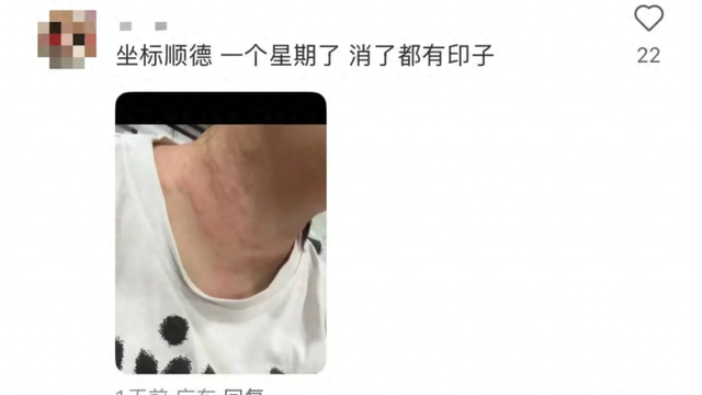 31省区市新增7例本土确诊病例-31省区市新增本土确诊4例-第3张图片