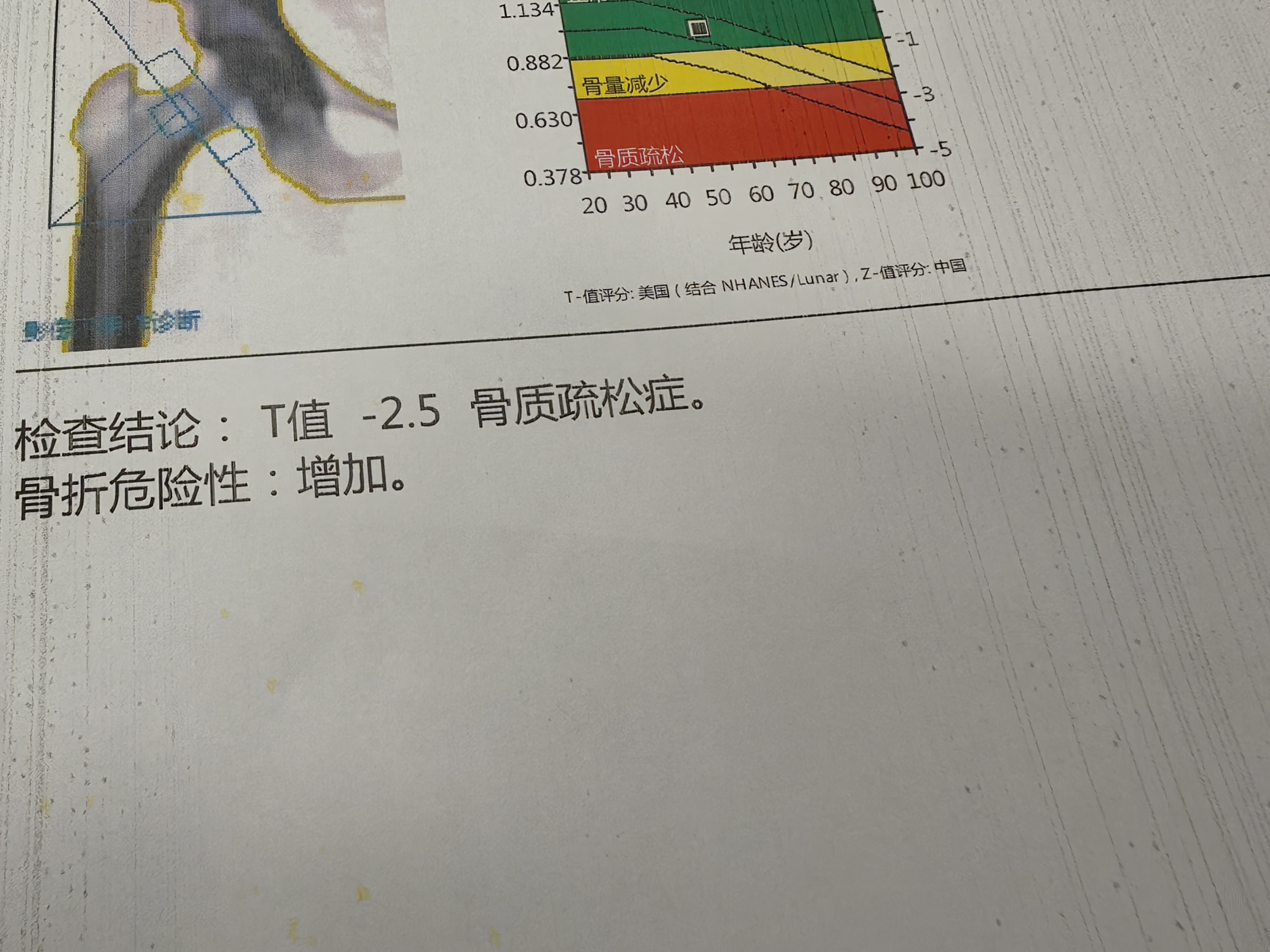 31省区市增62例本土,31省区市增62例本土确诊-第2张图片