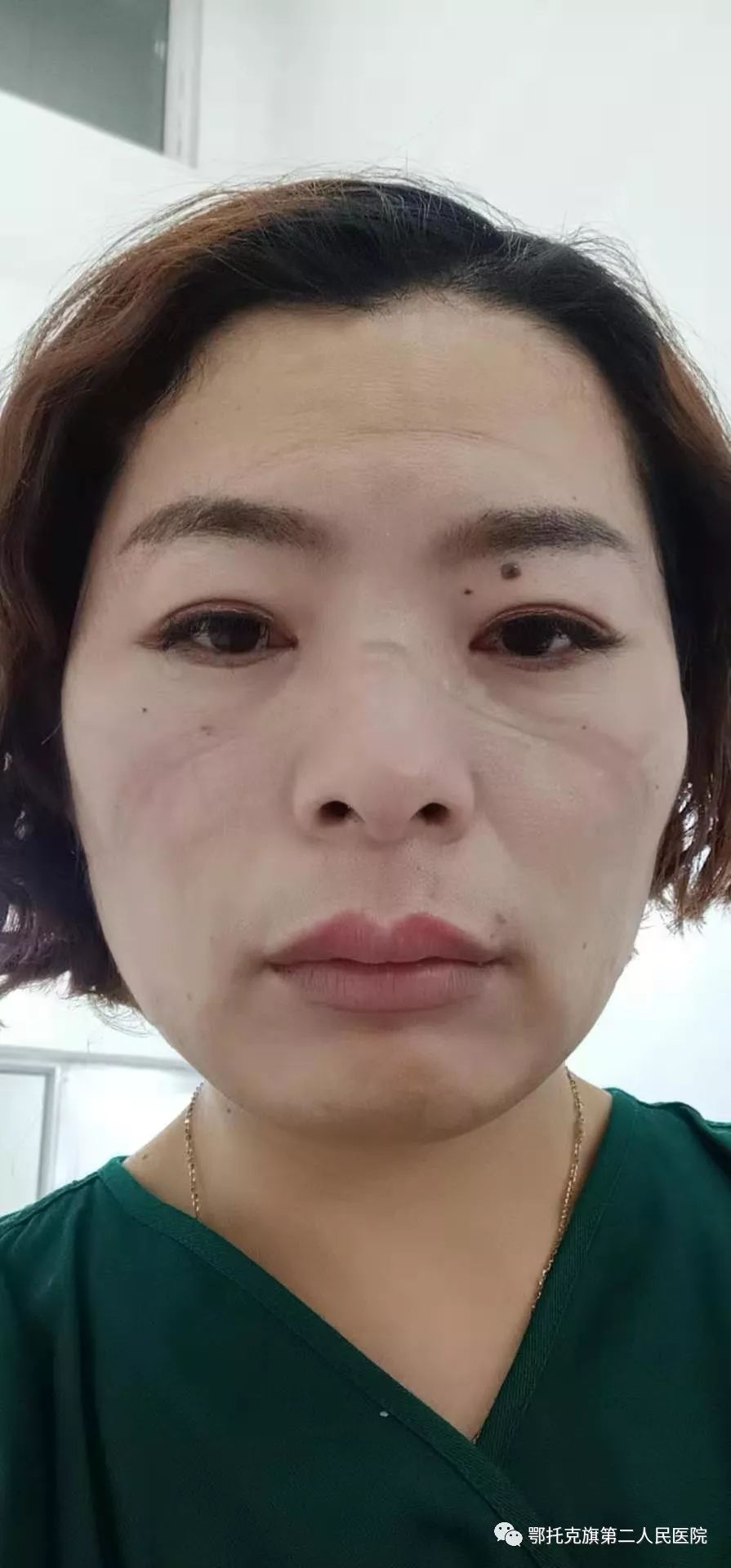 【大连疫情处于胶着期/大连疫情蔓延】-第2张图片