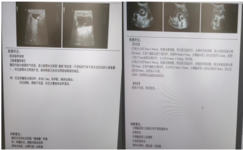 「新疆肺炎」〃新疆肺炎不排尿-第2张图片