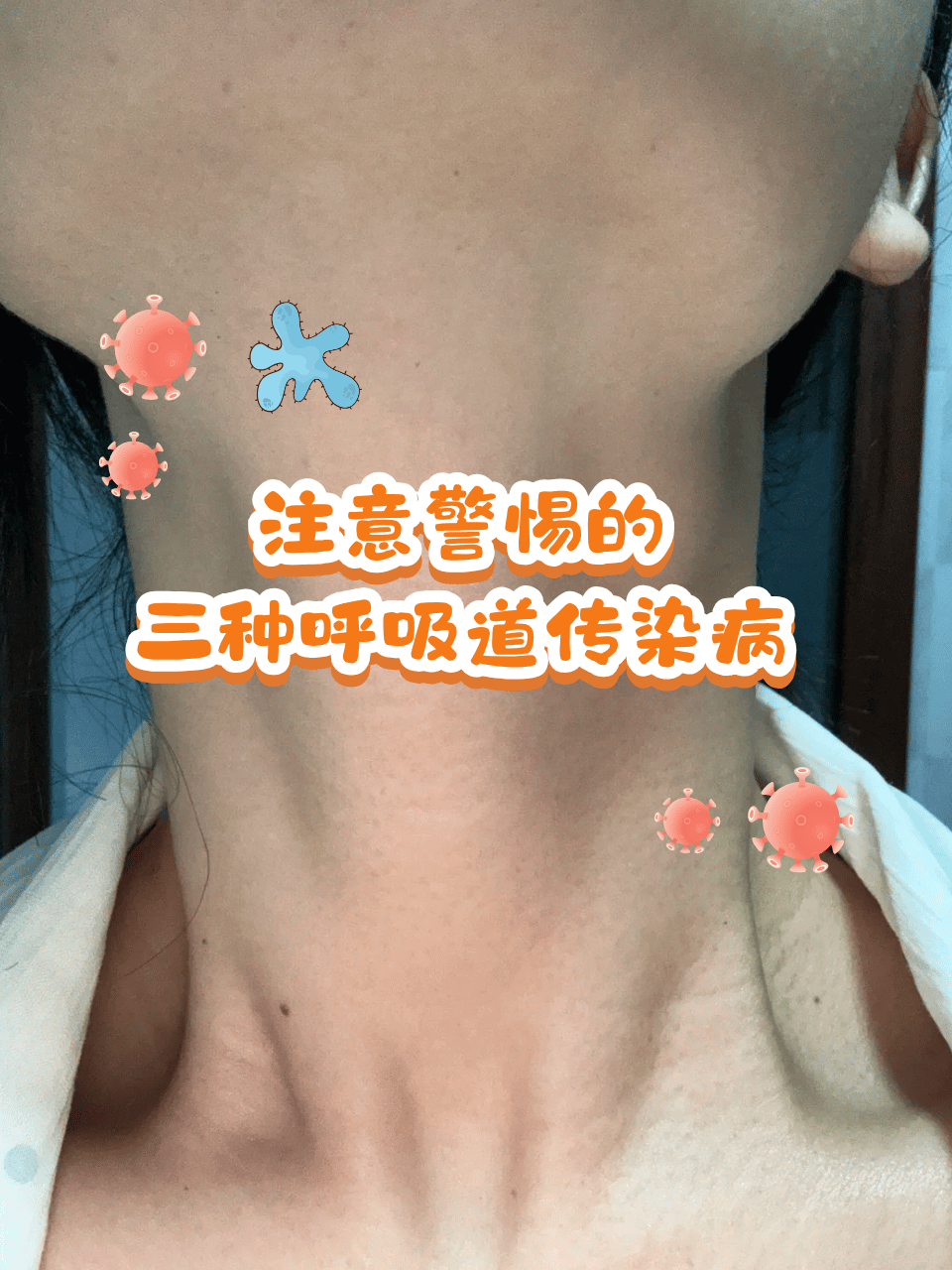 “最新新冠病毒	” 最新新冠病毒感染什么症状？-第2张图片