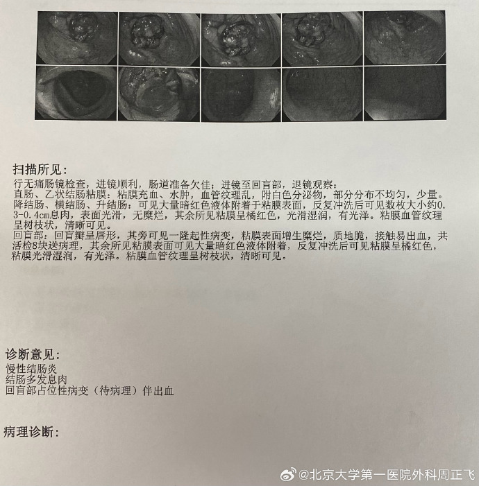 苏州确诊病例-苏州 确诊病例-第1张图片