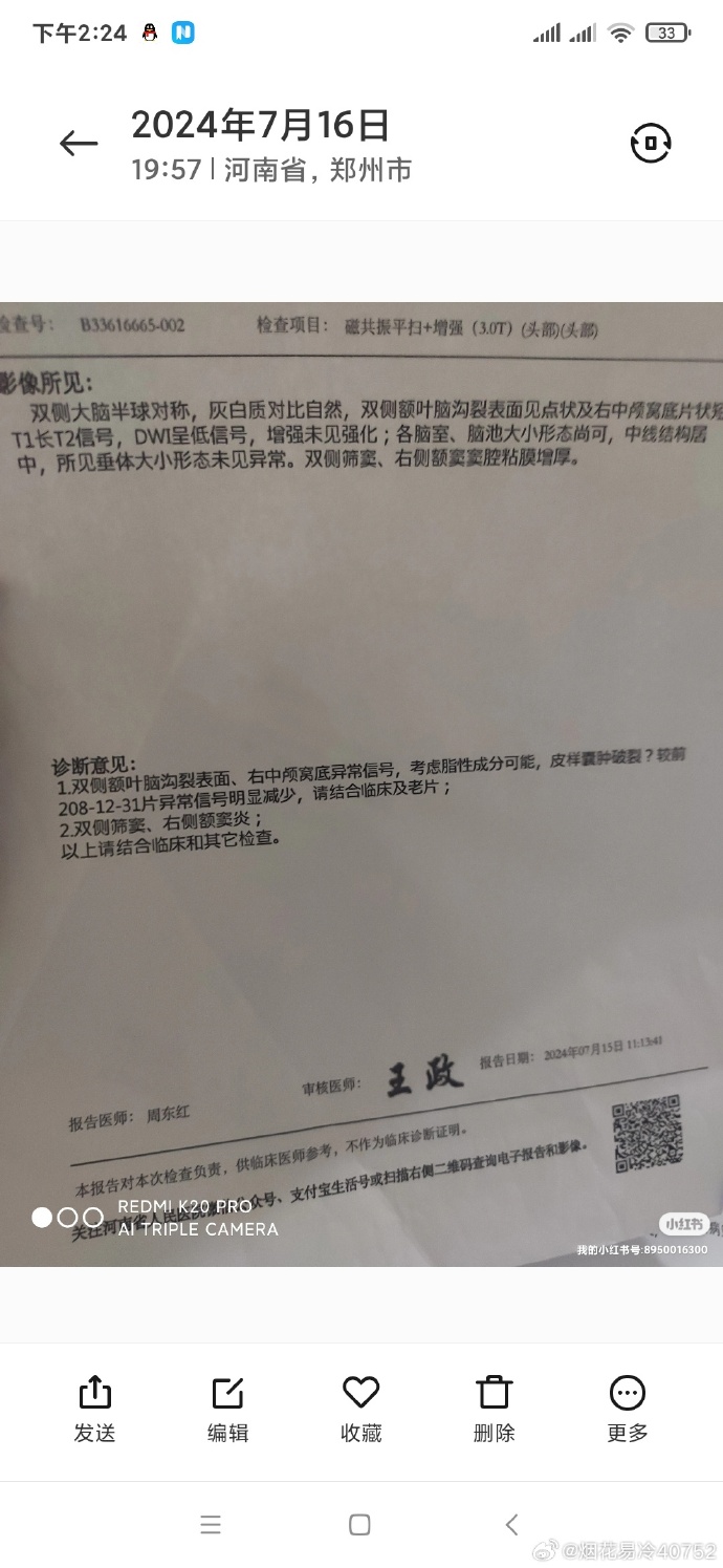 31省区市新增确诊28例,31省区市新增确诊病例27例